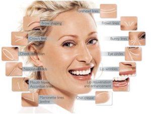 fillers