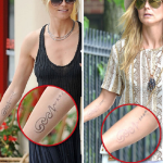 laser tattoo removal | tattoo removal