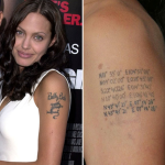 laser tattoo removal | tattoo removal