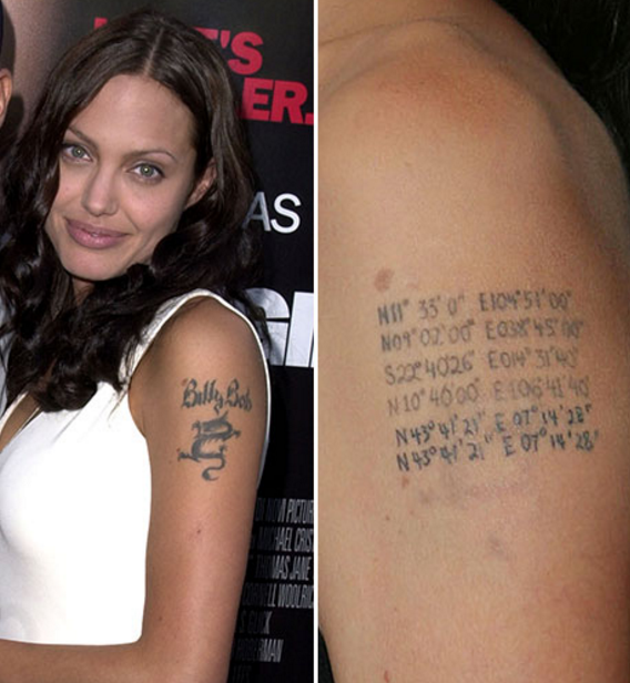 Celebrities who have had Tattoo Removal  Skin Medical