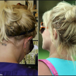 laser tattoo removal manchester | Skin medical