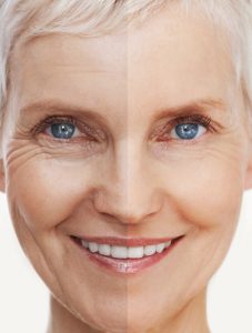 anti-ageing treatments