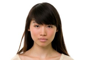 dermal fillers lips juvederm